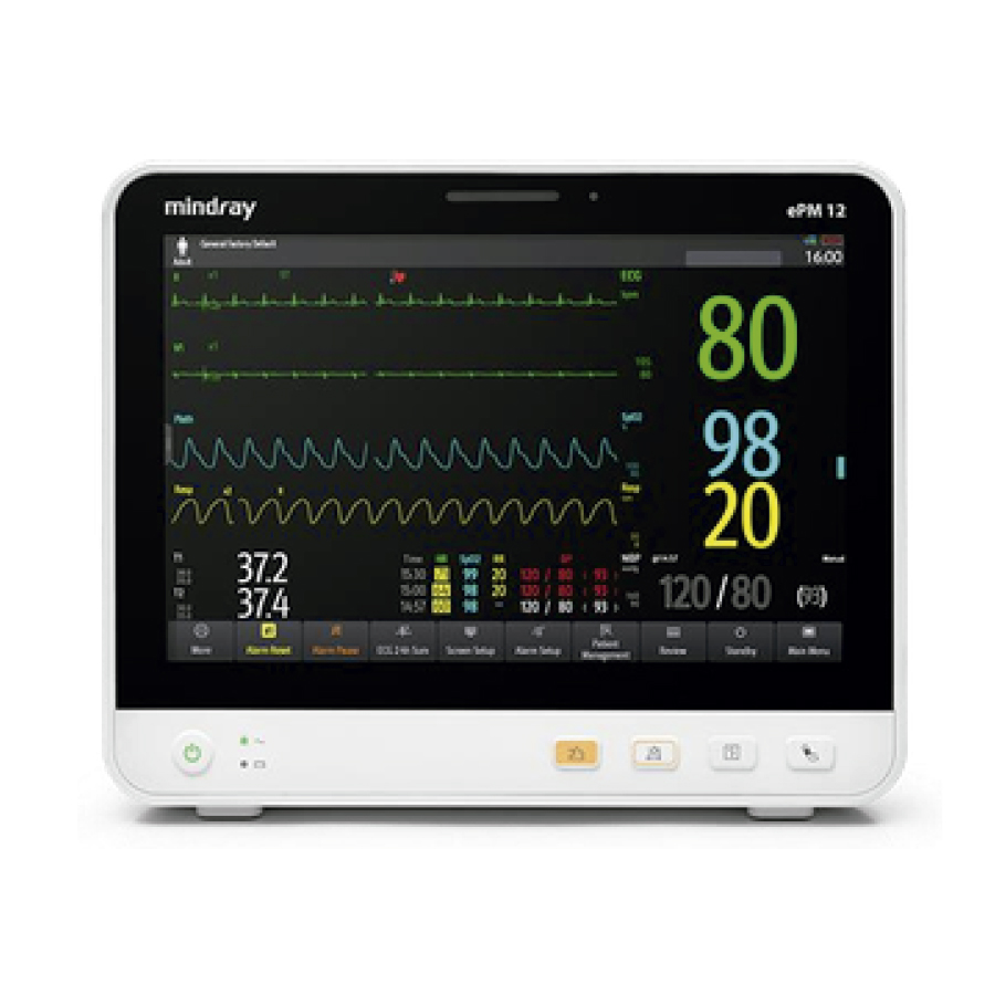 monitor epm 12 vet